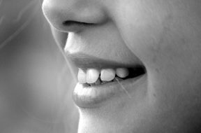 2017-04-24 16_31_40-smile-mouth-teeth-laugh-65665.jpeg ‎- Photos