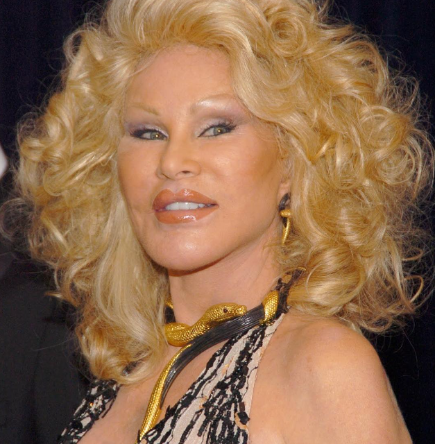 Shokon me deklaratën e saj, Jocelyn Wildenstein pretendon se nuk ka bërë kurrë operacione